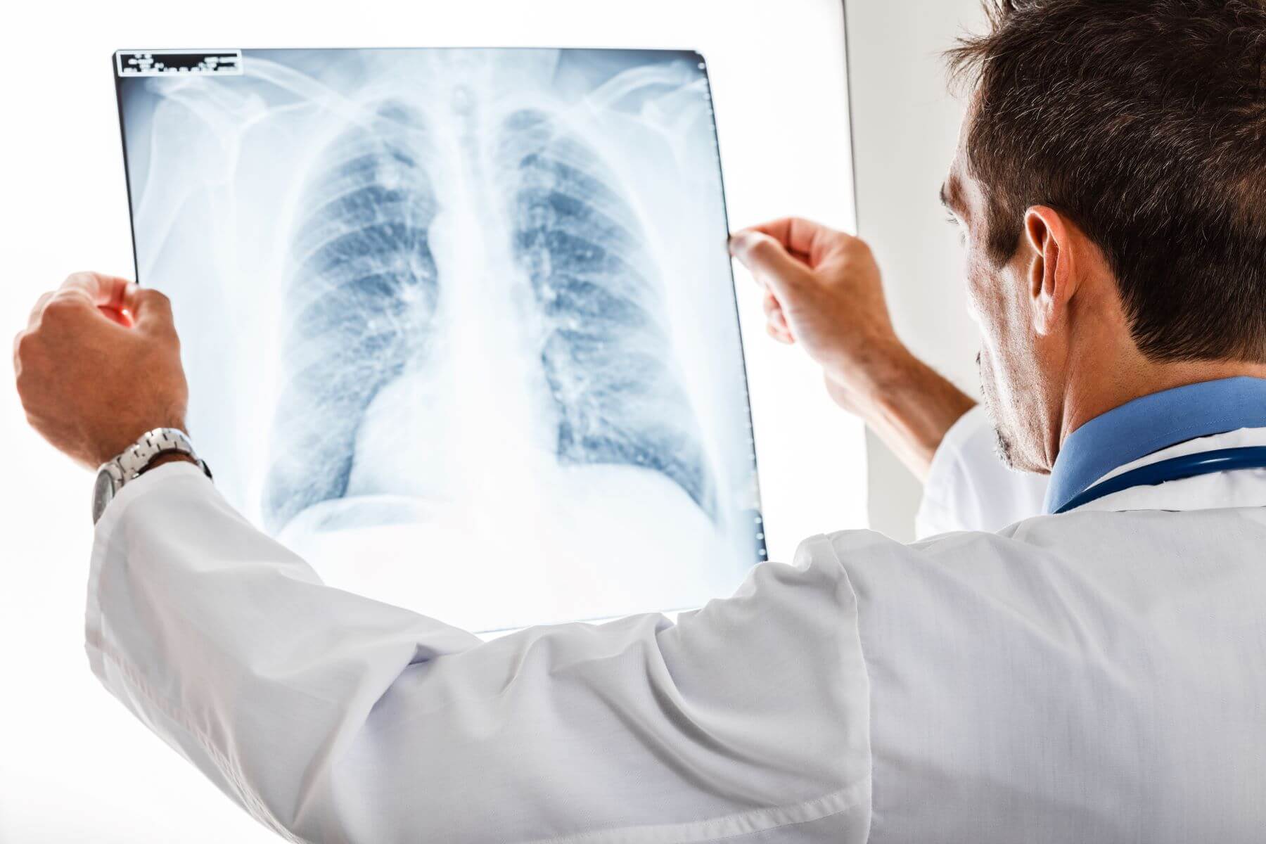 Jak zmniejszyć ryzyko raka płuc?